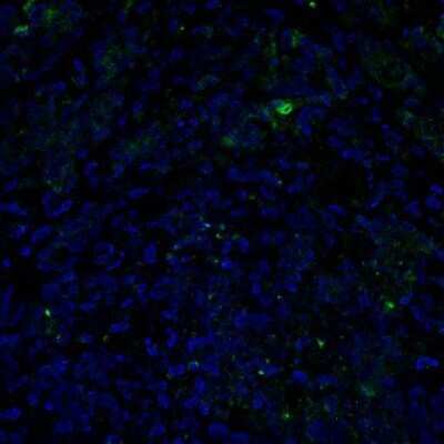 Immunohistochemistry-Paraffin: MMP-12 Antibody [NBP1-31225]