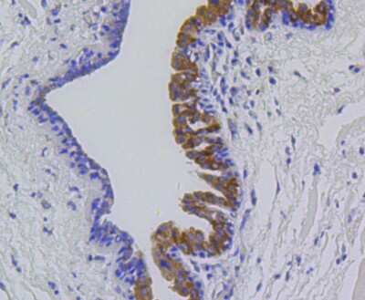 Immunohistochemistry-Paraffin: MMP-12 Antibody (SR03-23) [NBP2-67344]