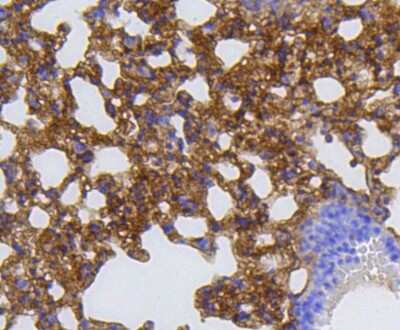 Immunohistochemistry-Paraffin: MMP-12 Antibody (SR03-23) [NBP2-67344]