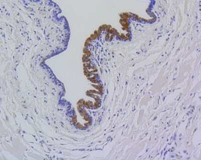 Immunohistochemistry-Paraffin: MMP-12 Antibody (SR03-23) [NBP2-67344]