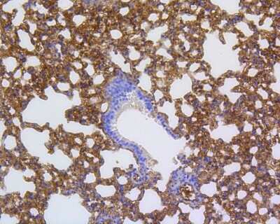 Immunohistochemistry-Paraffin: MMP-12 Antibody (SR03-23) [NBP2-67344]
