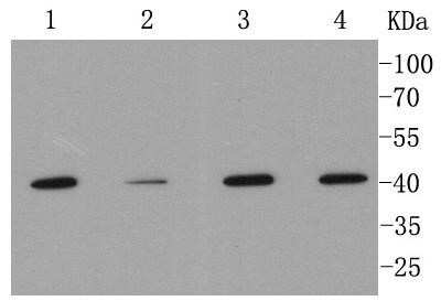 Western Blot: MMP-12 Antibody (SR03-23) [NBP2-67344]