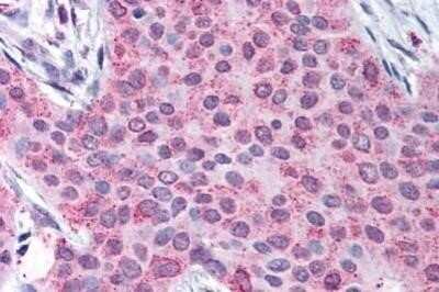 Immunohistochemistry-Paraffin: MMP-13 Antibody - BSA Free [NBP1-02339]