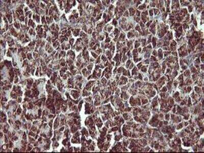 Immunohistochemistry-Paraffin: MMP-13 Antibody (OTI2D8) [NBP2-45887]
