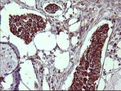 Immunohistochemistry-Paraffin: MMP-13 Antibody (OTI2D8) [NBP2-45887]