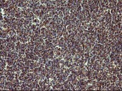 Immunohistochemistry-Paraffin: MMP-13 Antibody (OTI2D8) [NBP2-45887]