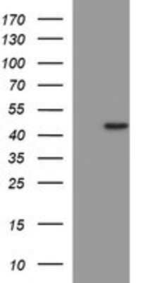 Western Blot: MMP-13 Antibody (OTI2D8) [NBP2-45887]