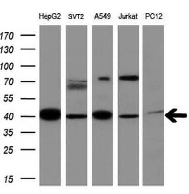 Western Blot: MMP-13 Antibody (OTI2D8) [NBP2-45887]
