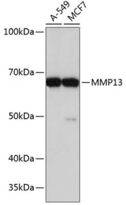 Western Blot: MMP-13 Antibody (8L8Q1) [NBP3-15346]