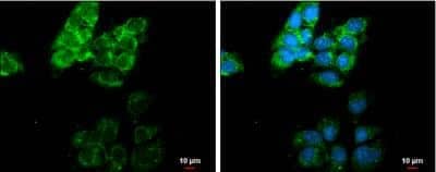 Immunocytochemistry/ Immunofluorescence: MMP-13 Antibody [NBP2-17310]