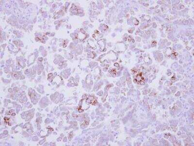 Immunohistochemistry-Paraffin: MMP-13 Antibody [NBP2-17310]
