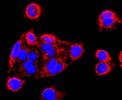 Immunocytochemistry/ Immunofluorescence: MMP-13 Antibody (JF0893) [NBP2-66954]