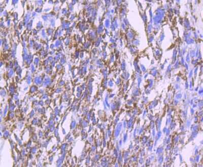 Immunohistochemistry-Paraffin: MMP-13 Antibody (JF0893) [NBP2-66954]