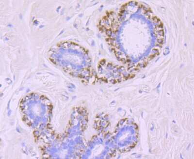 Immunohistochemistry-Paraffin: MMP-13 Antibody (JF0893) [NBP2-66954]