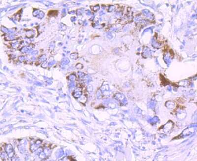 Immunohistochemistry-Paraffin: MMP-13 Antibody (JF0893) [NBP2-66954]