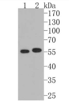 Western Blot: MMP-13 Antibody (JF0893) [NBP2-66954]