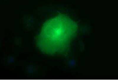 Immunocytochemistry/ Immunofluorescence: MMP-13 Antibody (OTI2D8) - Azide and BSA Free [NBP2-72740]