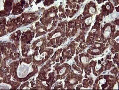 Immunohistochemistry: MMP-13 Antibody (OTI2D8) - Azide and BSA Free [NBP2-72740]