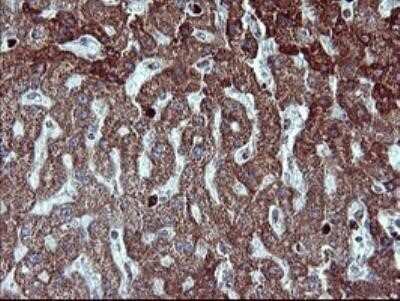 Immunohistochemistry: MMP-13 Antibody (OTI2D8) - Azide and BSA Free [NBP2-72740]