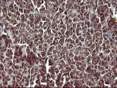 Immunohistochemistry: MMP-13 Antibody (OTI2D8) - Azide and BSA Free [NBP2-72740]
