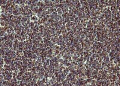 Immunohistochemistry-Paraffin: MMP-13 Antibody (OTI2D8) - Azide and BSA Free [NBP2-72740]