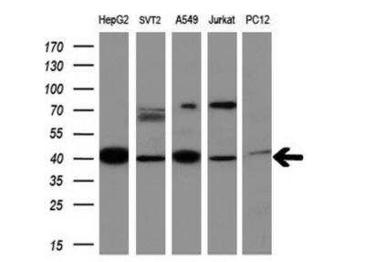 Western Blot: MMP-13 Antibody (OTI2D8)Azide and BSA Free [NBP2-72740]