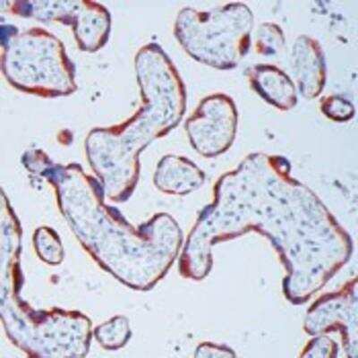 Immunohistochemistry-Paraffin: MMP-13 Antibody (VIIIA2) [NB110-5919]