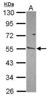 Western Blot: MMP-13 Antibody [NBP2-17310]