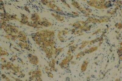 Immunohistochemistry: MMP-14/MT1-MMP Antibody (114-6G6) [NBP2-29699]