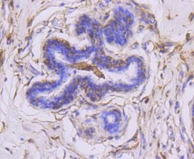 Immunohistochemistry-Paraffin: MMP-14/MT1-MMP Antibody (3-F7) [NBP2-67415]