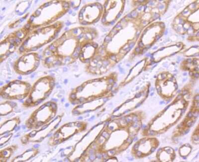 Immunohistochemistry-Paraffin: MMP-14/MT1-MMP Antibody (3-F7) [NBP2-67415]