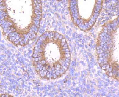 Immunohistochemistry-Paraffin: MMP-14/MT1-MMP Antibody (3-F7) [NBP2-67415]