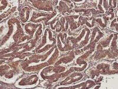 Immunohistochemistry-Paraffin: MMP-14/MT1-MMP Antibody (3-F7) [NBP2-67415]