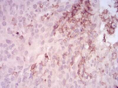 Immunohistochemistry-Paraffin: MMP-14/MT1-MMP Antibody (6A11D1) - BSA Free [NBP2-52512]