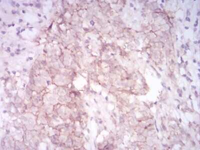Immunohistochemistry-Paraffin: MMP-14/MT1-MMP Antibody (6A11D1) - BSA Free [NBP2-52512]