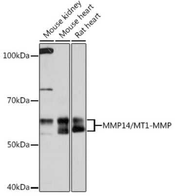 Western Blot: MMP-14/MT1-MMP Antibody (6T7L3) [NBP3-15247]