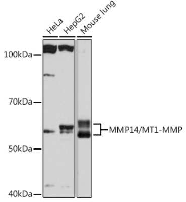Western Blot: MMP-14/MT1-MMP Antibody (6T7L3) [NBP3-15247]