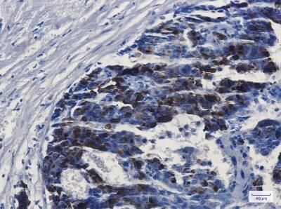Immunohistochemistry-Paraffin: MMP-14/MT1-MMP Antibody (S05-6H5) [NBP3-19491]