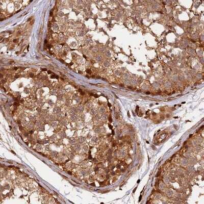 Immunohistochemistry: MMP-15/MT2-MMP Antibody [NBP2-32613]