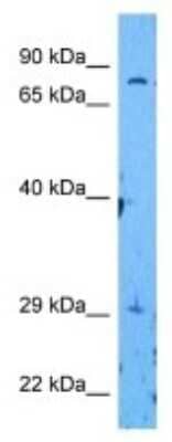 Western Blot: MMP-15/MT2-MMP Antibody [NBP3-10016]