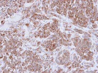 Immunohistochemistry-Paraffin: MMP-16/MT3-MMP Antibody [NBP1-33102]