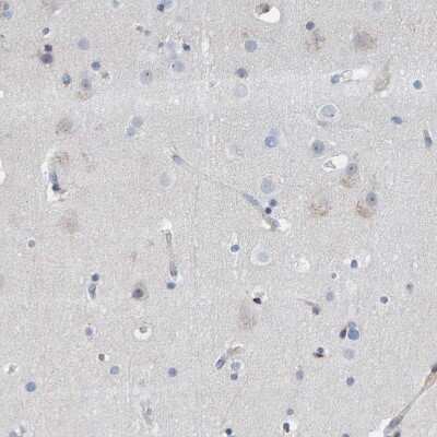 Immunohistochemistry-Paraffin: MMP-16/MT3-MMP Antibody [NBP1-86721]