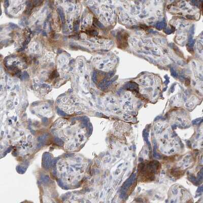 Immunohistochemistry-Paraffin: MMP-16/MT3-MMP Antibody [NBP1-86721]