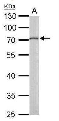 Western Blot: MMP-16/MT3-MMP Antibody [NBP1-33102]