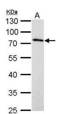 Western Blot: MMP-16/MT3-MMP Antibody [NBP1-33102]