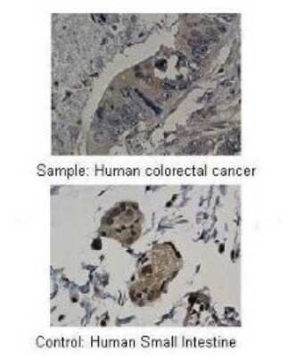Immunohistochemistry-Paraffin: MMP-19 Antibody [NBP1-57092]