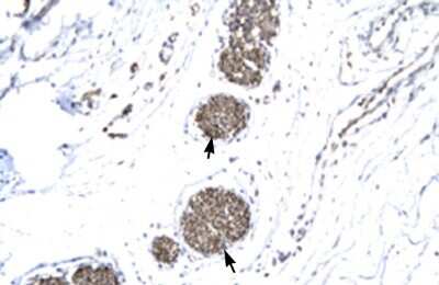 Immunohistochemistry-Paraffin: MMP-19 Antibody [NBP1-57092]