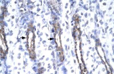 Immunohistochemistry-Paraffin: MMP-19 Antibody [NBP1-57092]