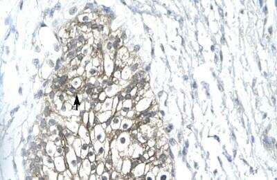 Immunohistochemistry-Paraffin: MMP-19 Antibody [NBP1-57094]