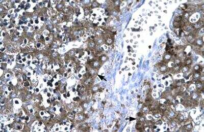 Immunohistochemistry-Paraffin: MMP-19 Antibody [NBP1-57094]